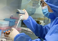 2020年1月10日，，，pg电子中国生物上海捷诺用不到48小时，，，天下首家乐成研制出新冠病毒核酸检测试剂盒并供应抗击疫情一线。。。